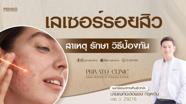 เลเซอร์รอยสิว กี่ครั้งเห็นผล จางรอยดำใน 6 สัปดาห์