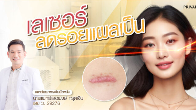 เลเซอร์ลดรอยแผลเป็น