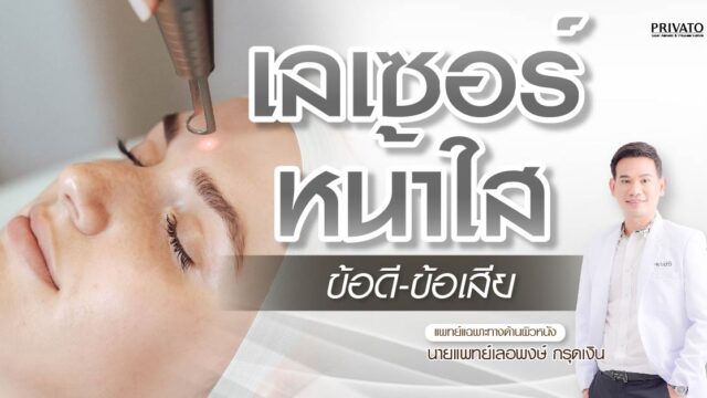 เลเซอร์หน้าใส: ข้อดี ข้อเสีย ที่คุณควรรู้ก่อนทำ
