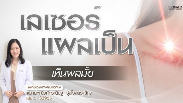 เลเซอร์แผลเป็น คืออะไร ราคาโดยรวม กี่ครั้งเห็นผล