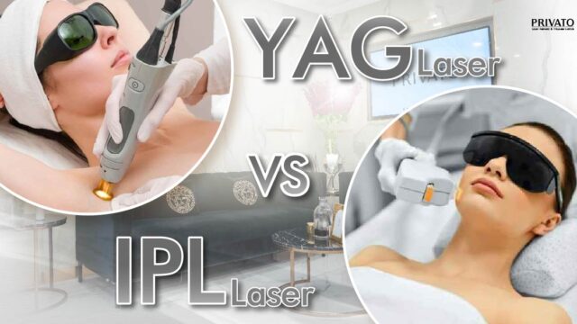 IPL กับ YAG คืออะไร ต่างกันอย่างไร แบบไหนดีกว่ากัน?