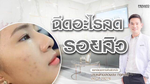 ฉีดอะไรลดรอยสิว? เปิดราคาทุกหัตถการยอดนิยมที่เห็นผลจริง
