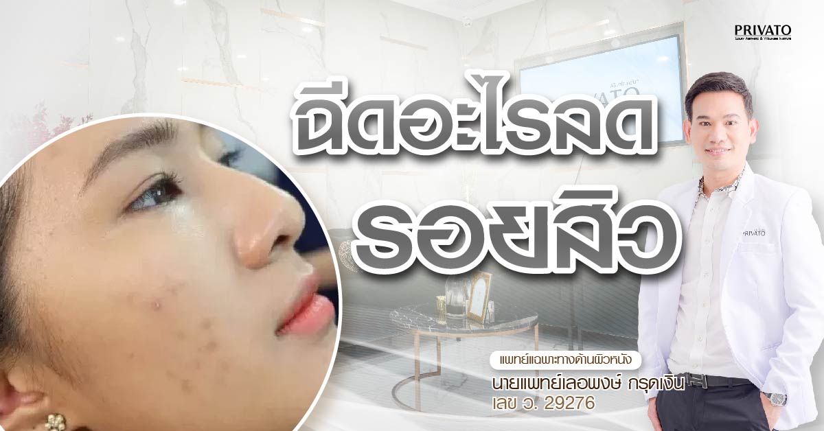 ฉีดอะไรลดรอยสิว? เปิดราคาทุกหัตถการยอดนิยมที่เห็นผลจริง