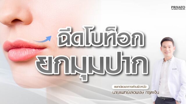 ฉีดโบท็อกยกมุมปาก ราคาเท่าไหร่? ต้องใช้กี่ยูนิต? อัปเดต 2568