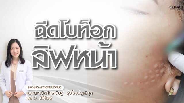 โบท็อกลิฟกรอบหน้า ใช้กี่ยูนิต? กี่วันเห็นผล? อยู่ได้นานแค่ไหน?