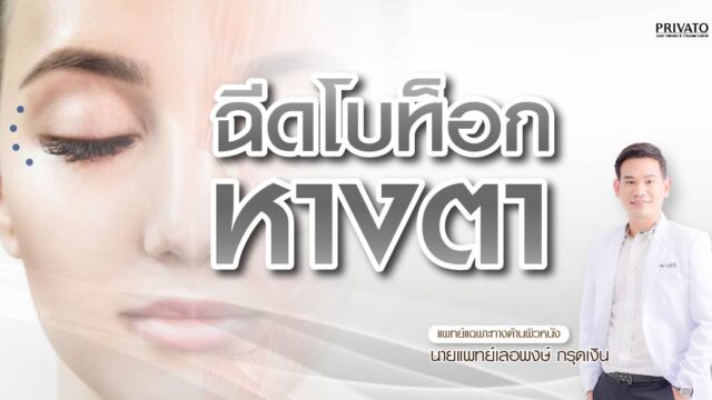 ฉีดโบท็อกซ์ยกหางตา ลดริ้วรอยตีนกา เห็นผลจริงไหม? อัปเดต 2568