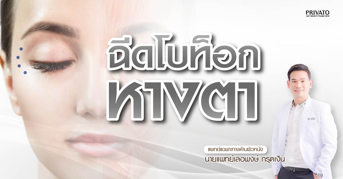 ฉีดโบท็อกซ์ยกหางตา ลดริ้วรอยตีนกา เห็นผลจริงไหม? อัปเดต 2568