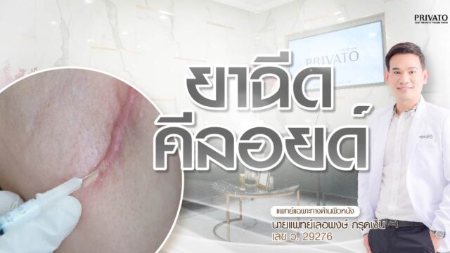 ยาฉีดคีลอยด์: ราคาเท่าไหร่? ฉีดกี่ครั้ง? มีผลข้างเคียงไหม?