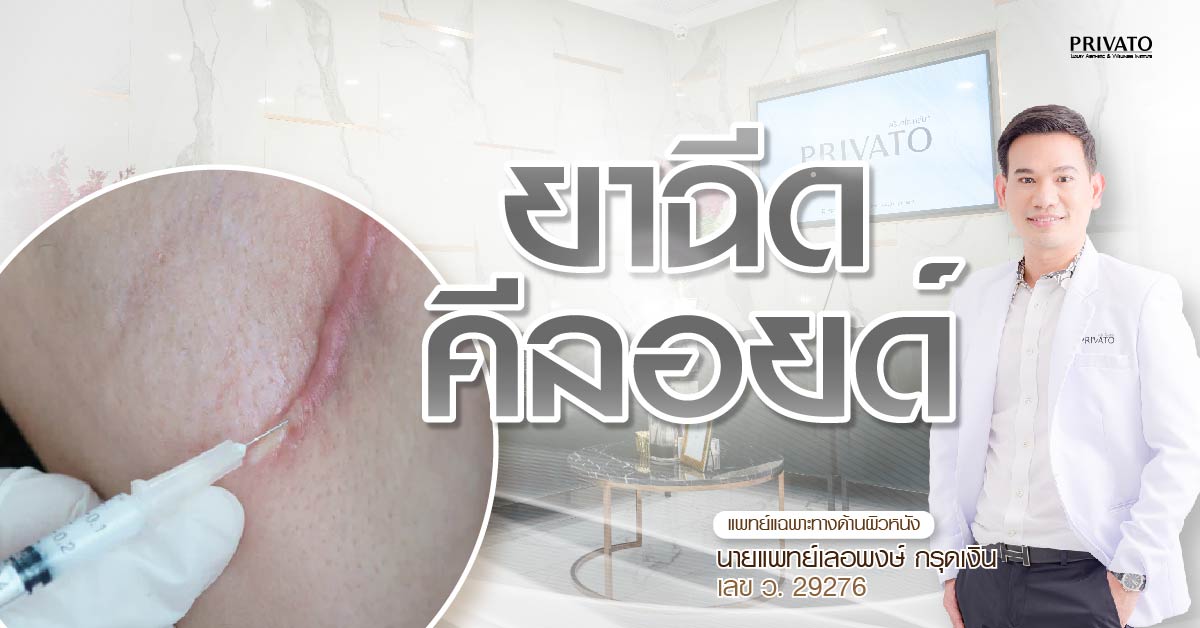 ยาฉีดคีลอยด์: ราคาเท่าไหร่? ฉีดกี่ครั้ง? มีผลข้างเคียงไหม?