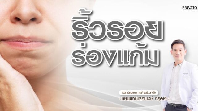 ร่องแก้มลึก แก้ด้วยฟิลเลอร์ โบท็อกซ์ หรือ Hifu? แบบไหนดีกว่ากัน