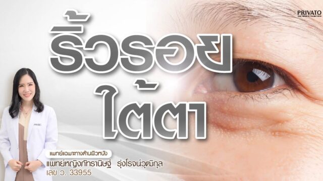 ริ้วรอยใต้ตา เลือกฟิลเลอร์ โบท็อกซ์ หรือ Ulthera ดี? 2025