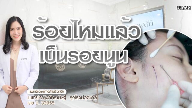 ร้อยไหมแล้วเป็นรอยนูน แบบไหนอันตราย? สัญญาณต้องรีบพบแพทย์