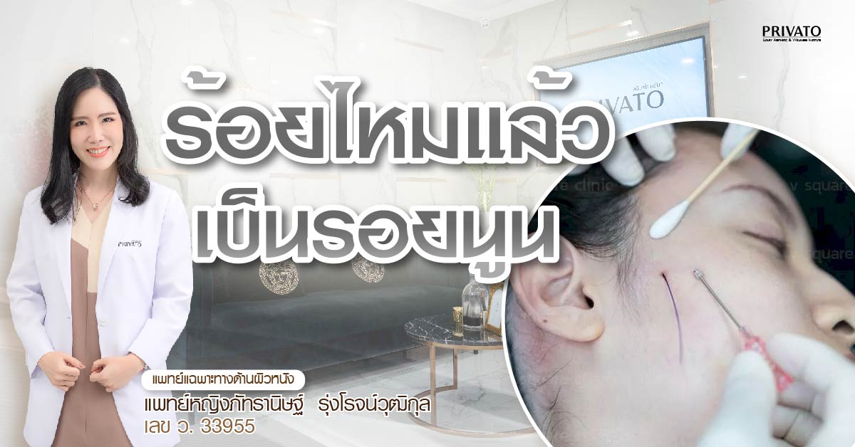 ร้อยไหมแล้วเป็นรอยนูน แบบไหนอันตราย? สัญญาณต้องรีบพบแพทย์