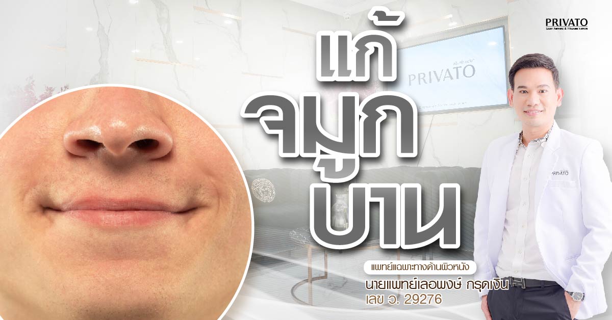 แก้จมูกบาน วิธีไหนดี? เปรียบเทียบชัดๆ ระหว่างศัลยกรรม vs ไม่ศัลยกรรม