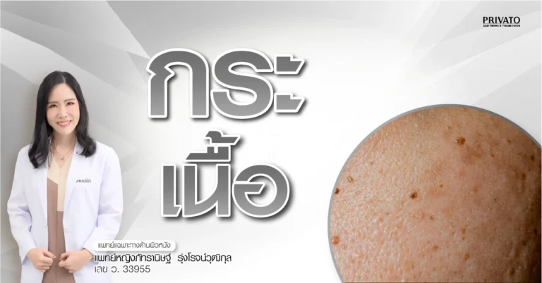 กระเนื้อ คืออะไร เกิดจากอะไร วิธีรักษาและป้องกัน