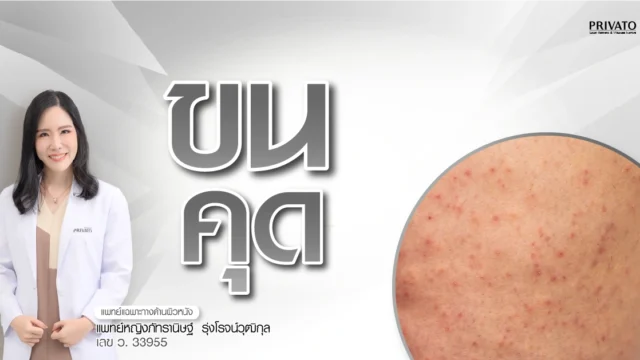 ขนคุดคืออะไร เกิดจากอะไร วิธีรักษาให้ผิวเรียบเนียน