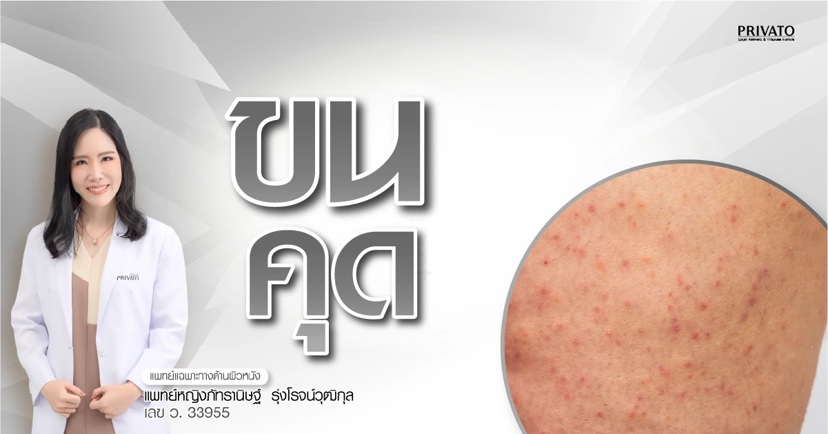 ขนคุดคืออะไร เกิดจากอะไร วิธีรักษาให้ผิวเรียบเนียน