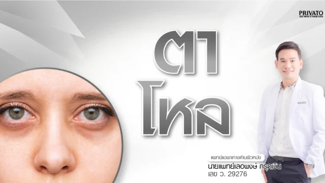 ตาโหล เบ้าตาลึก เกิดจากอะไร รักษาด้วยวิธีไหนเห็นผล 2568