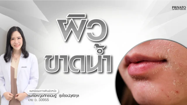 ผิวขาดน้ำแก้ยังไงดี? วิธีดูแลให้กลับมานุ่มชุ่มชื้น