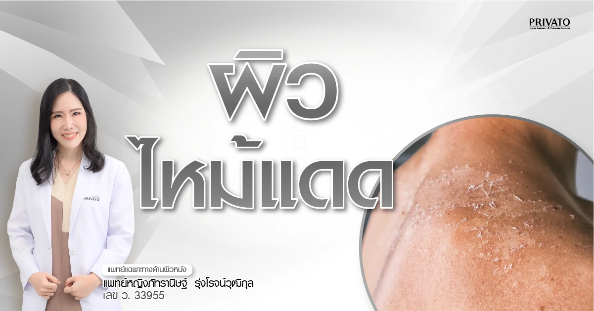 7 วิธีแก้ผิวไหม้แดดเร่งด่วน ลดอาการแสบแดง-ผิวลอก อัปเดต 2568