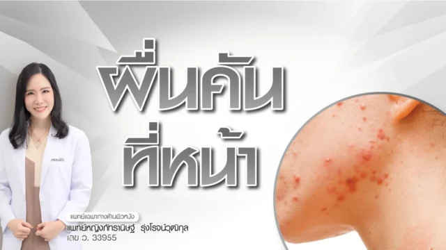 ผื่นคันที่หน้า สาเหตุ อาการ และวิธีรักษาให้หายขาด