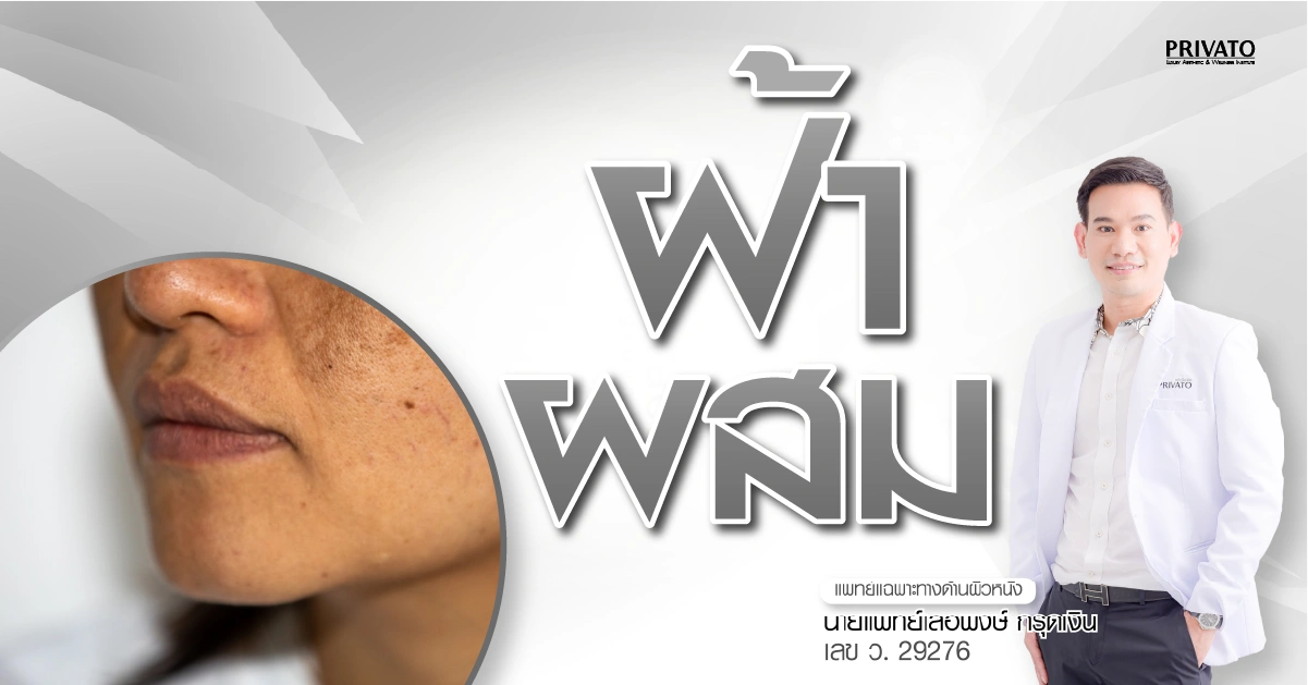 ฝ้าผสม คืออะไร? สาเหตุ อาการ และวิธีรักษาให้หน้ากลับมาใส