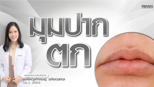 มุมปากตก เกิดจากอะไร สาเหตุ และวิธีแก้ไขให้หน้าดูอ่อนเยาว์