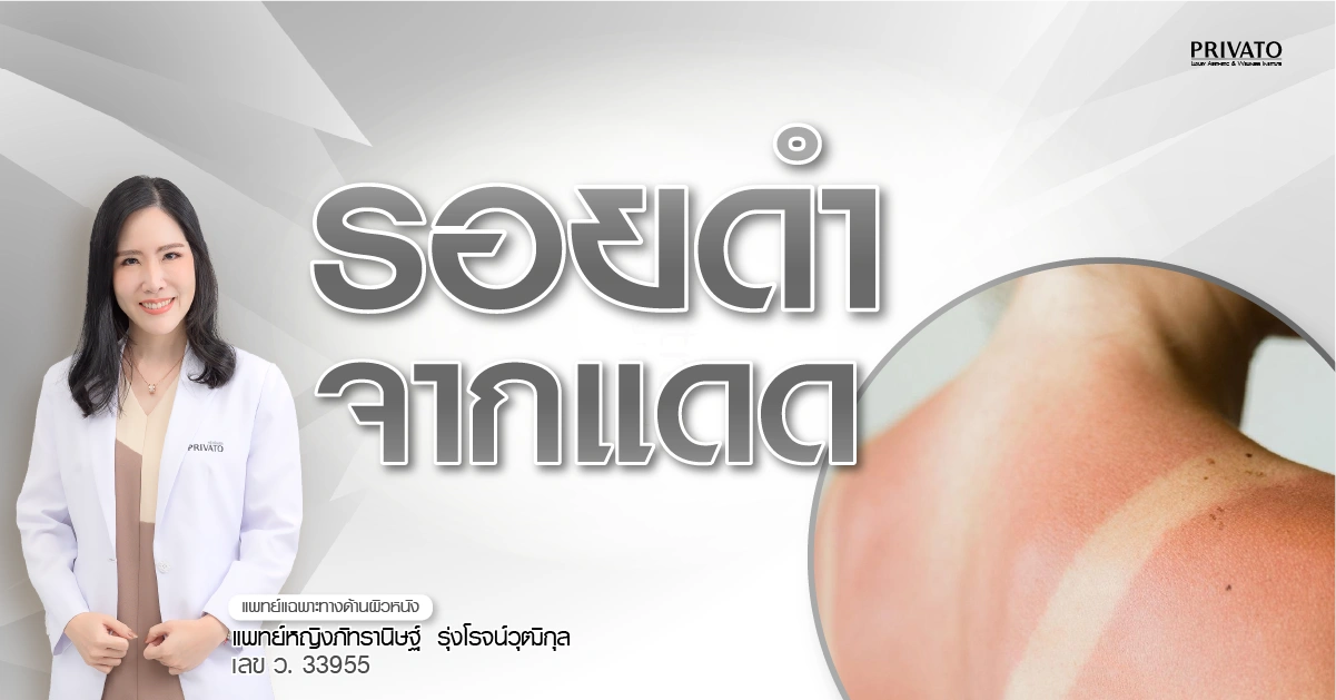 ผิวดำแดดกี่วันหาย? รวมวิธีฟื้นฟูรอยคล้ำจากแดดให้กลับมาขาวใส