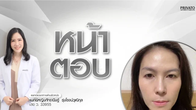 หน้าตอบ แก้มตอบ แก้ยังไงให้อิ่มฟู วิธีไหนดีที่สุด 2568