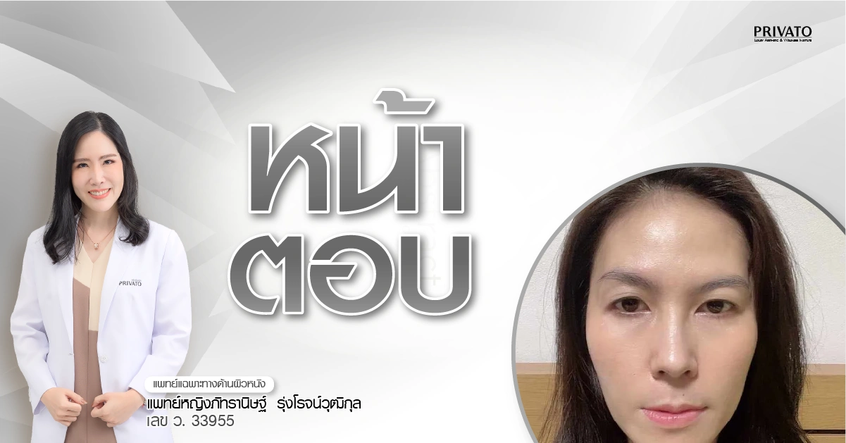 หน้าตอบ แก้มตอบ แก้ยังไงให้อิ่มฟู วิธีไหนดีที่สุด 2568