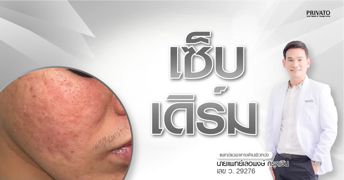 เซ็บเดิร์ม (Seborrheic Dermatitis) คืออะไร สาเหตุ อาการ และวิธีรักษา