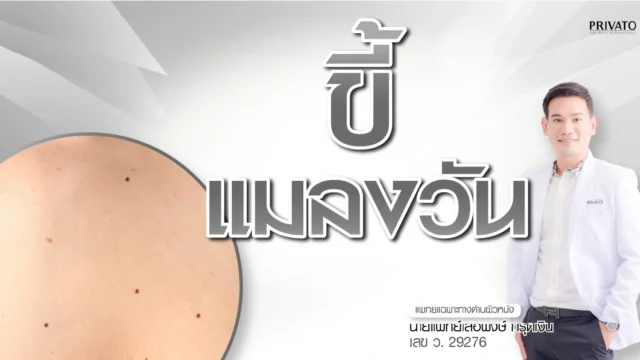 ขี้แมลงวัน เกิดจากอะไร สาเหตุและวิธีกำจัด