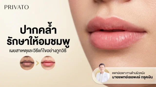 ปากคล้ำ สาเหตุและวิธีรักษาให้กลับมาอมชมพู