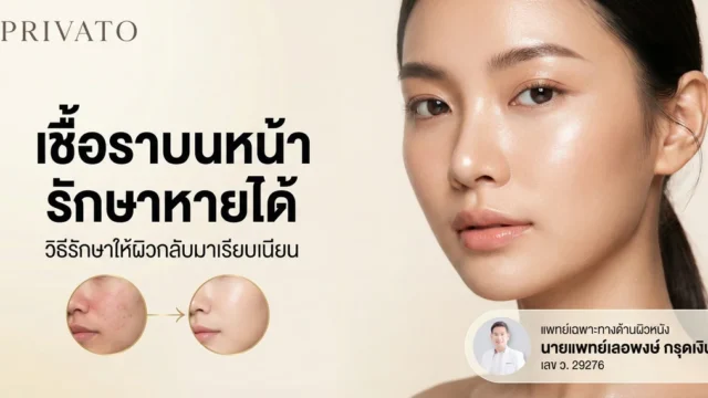 เชื้อราบนหน้า