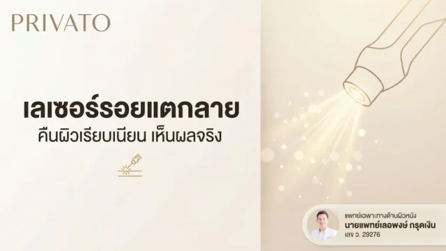 เลเซอร์รอยแตกลาย คืนผิวเรียบเนียน เห็นผลจริงไหม ราคาเท่าไหร่