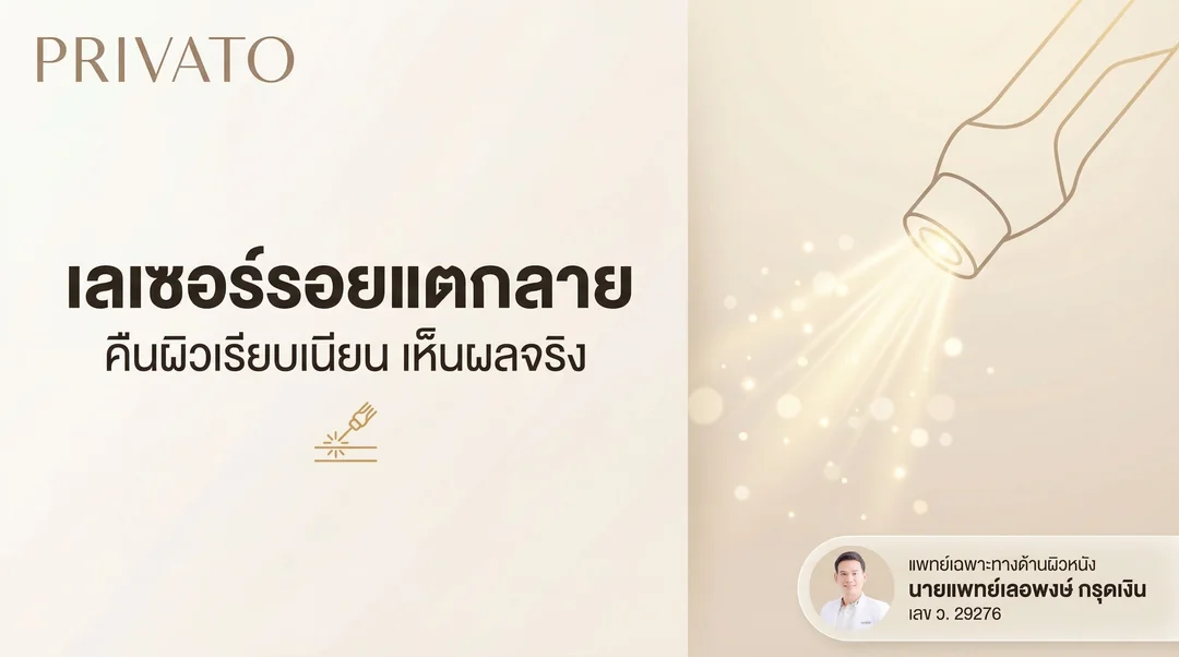 เลเซอร์รอยแตกลาย คืนผิวเรียบเนียน เห็นผลจริงไหม ราคาเท่าไหร่