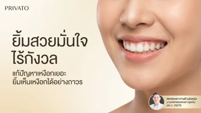 ยิ้มเห็นเหงือก (Gummy Smile) เกิดจากอะไร แก้ไขอย่างไรให้ยิ้มสวยมั่นใจ