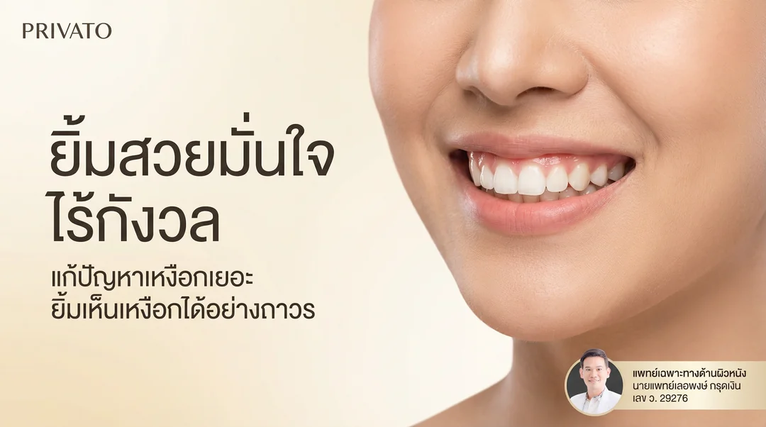 ยิ้มเห็นเหงือก (Gummy Smile) เกิดจากอะไร แก้ไขอย่างไรให้ยิ้มสวยมั่นใจ
