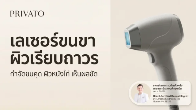 เลเซอร์ขนขา ดีไหม? ช่วยให้ผิวเรียบเนียนถาวร ราคาเท่าไหร่ อัปเดต 2568