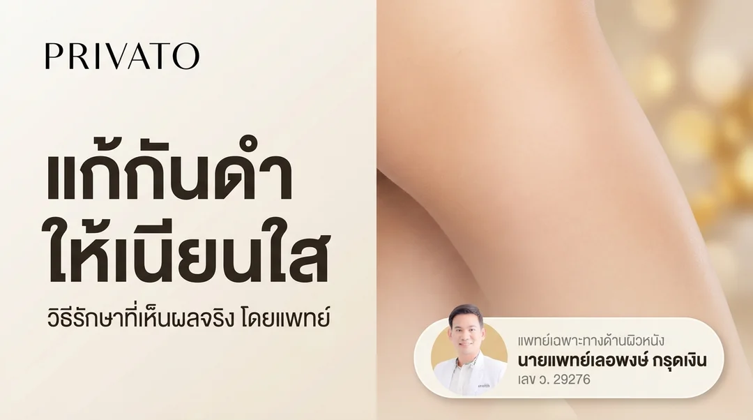 ก้นดำ ก้นลาย เกิดจากอะไร? วิธีแก้ให้เนียนใสเห็นผลจริง