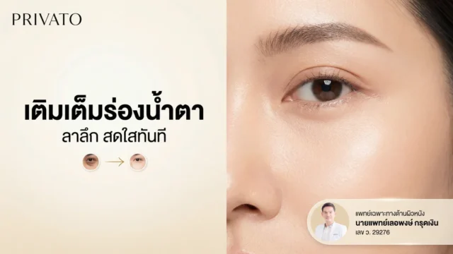 ร่องน้ำตา (Tear Trough) คืออะไร? เจาะลึกสาเหตุและวิธีแก้ร่องใต้ตาลึกให้กลับมาสดใส