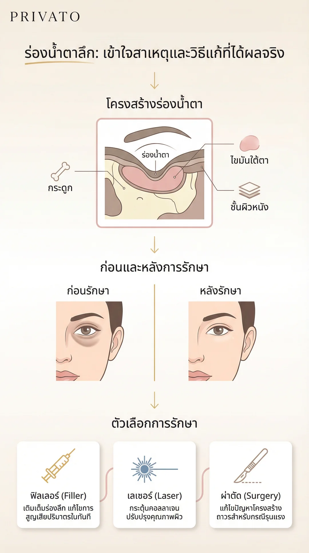 ร่องน้ำตา (Tear Trough) คืออะไร? เจาะลึกสาเหตุและวิธีแก้ร่องใต้ตาลึกให้กลับมาสดใส Infographic