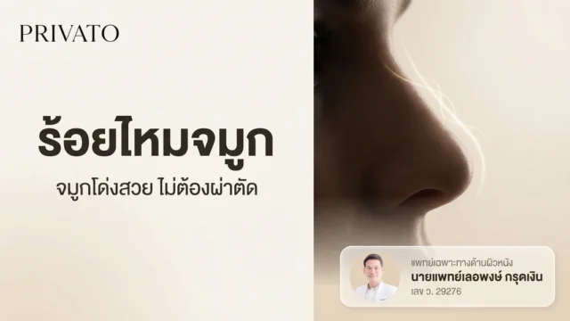 ร้อยไหมจมูก คืออะไร ช่วยให้จมูกโด่งสวยได้จริงไหม พร้อมสรุปข้อดี-ข้อเสีย ปี 2568