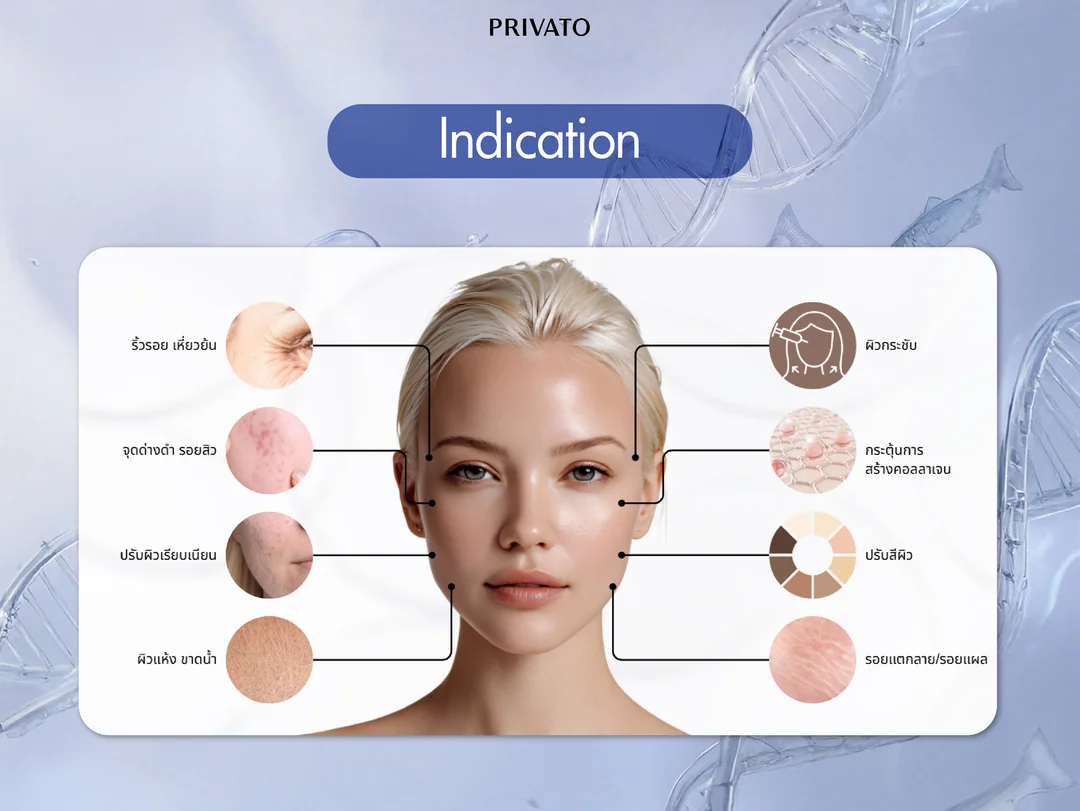Nucleofill Strong เหมาะสำหรับใคร