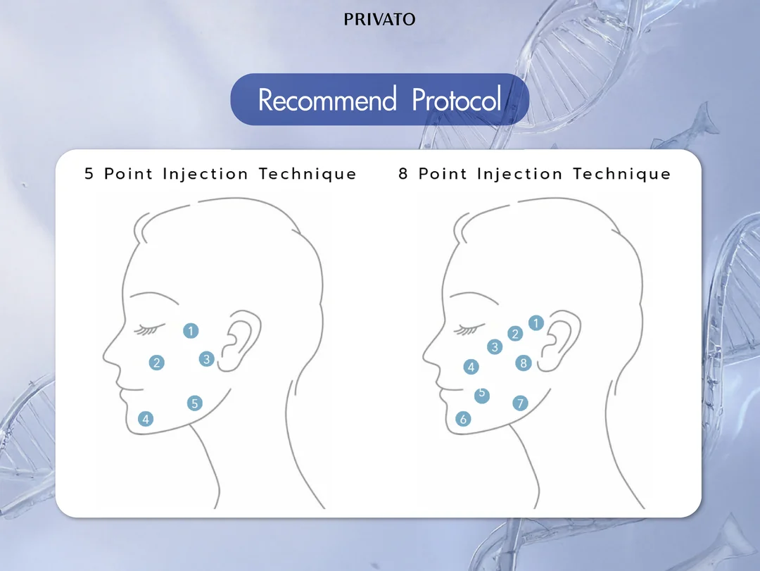ตำแหน่งทั้ง 5 จุด และ 8 จุด