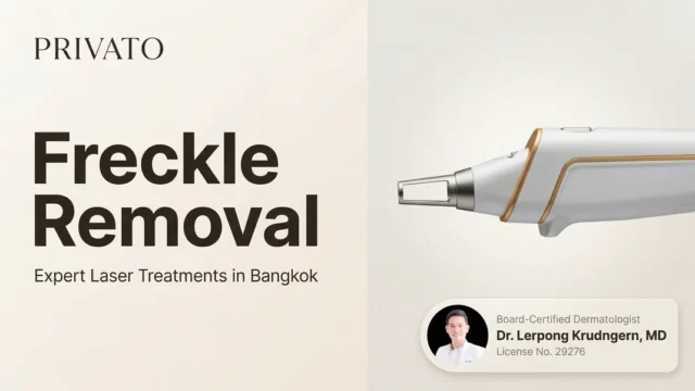 Freckle Removal in Bangkok: Best Laser Treatments and Clinic Guide
