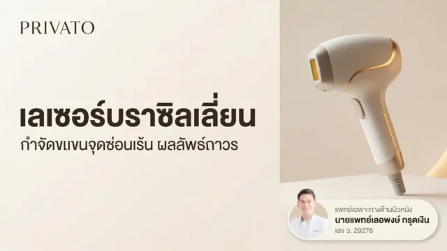 เลเซอร์บราซิลเลี่ยน (Brazilian Laser) คืออะไร ช่วยเรื่องอะไรบ้าง พร้อมรีวิวและราคา