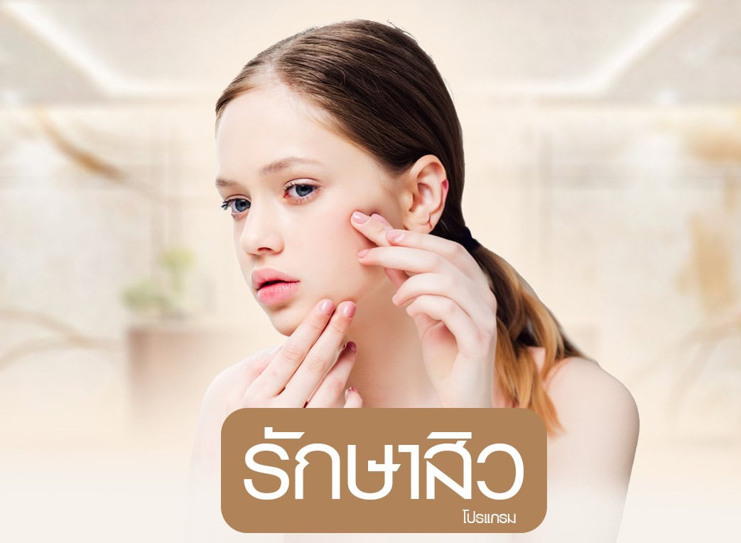 รักษาสิว