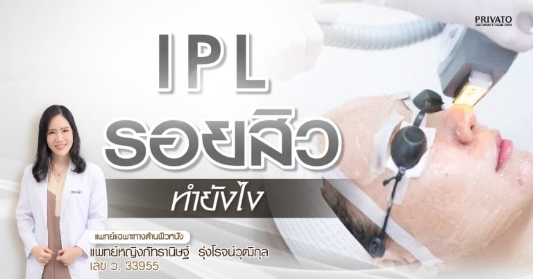 IPL เลเซอร์ลดรอยสิว ข้อควรทำ-ห้ามทำ หลังการรักษา