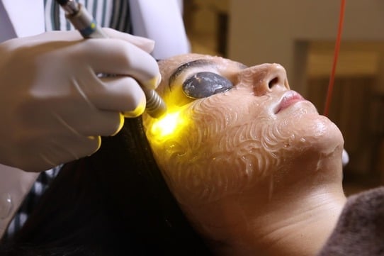 Laser treatment at Privato Clinic